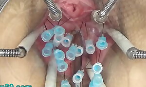 Extreme German BDSM Needles inside Pussy Cervix enlargened wide of Tits