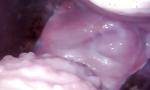Vagina endoscope
